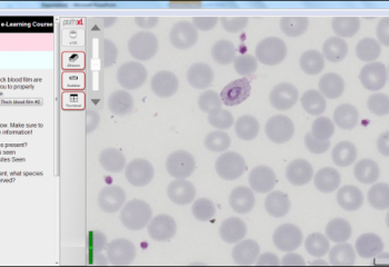 Intellectual Ventures Develops the First Offline Virtual Malaria Microscopy Training Course