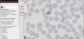 Intellectual Ventures Develops the First Offline Virtual Malaria Microscopy Training Course